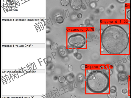 智能化类器官检测11